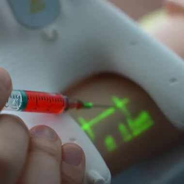 Arterya, la start-up caennaise qui révolutionne la détection des artères 